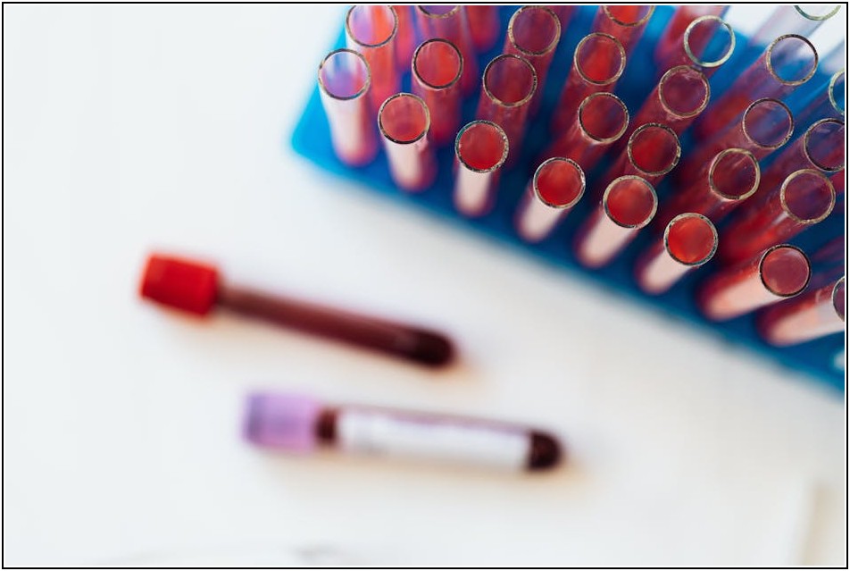 투명 비닐봉지, 제대로 알고 쓰자! 종류별 특징과 용도 파헤치기