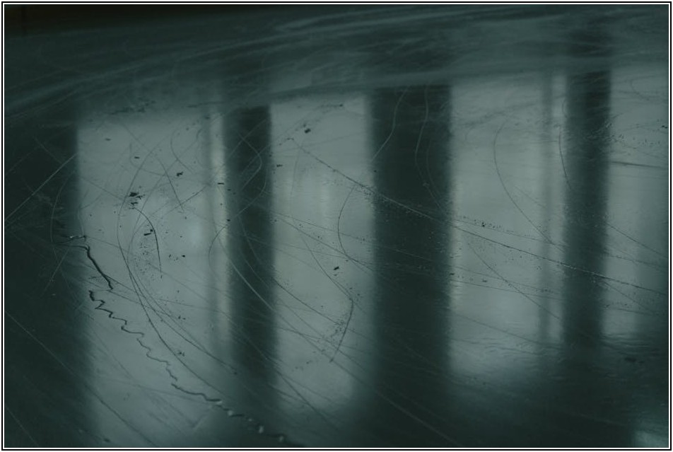 집에서 하는 허리 협착증 완화 운동, 효과는?